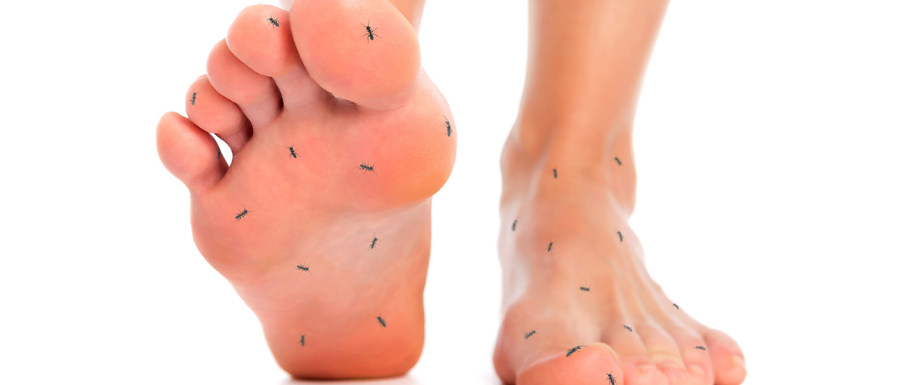 Diabetes and feet – Diabetic neuropathy symptoms